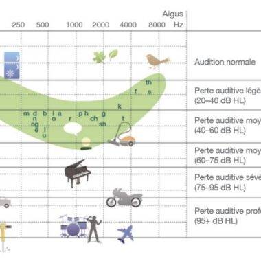 AudiogrammePerte