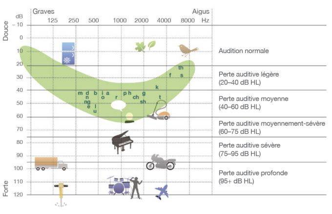Comprendre un résultat d’audiogramme auditif